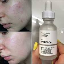 The Ordinary Niacinamide 10% + Zinc 1% ( with batch code )