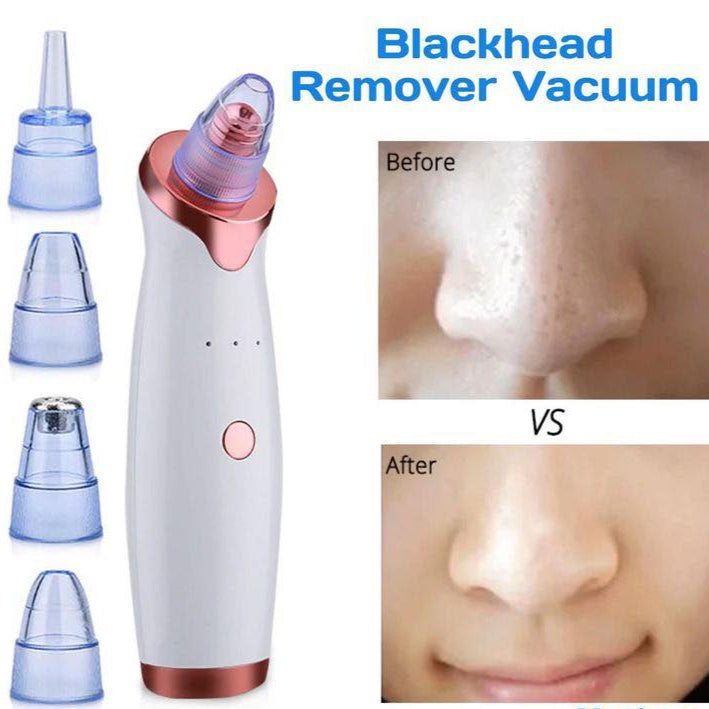 Blackhead Remover Vacuum – Electric Pore Cleaner Machine for Acne, Black Spots & Deep Facial Cleansing