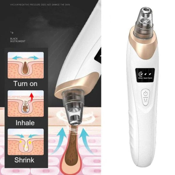 Blackhead Remover Vacuum – Electric Pore Cleaner Machine for Acne, Black Spots & Deep Facial Cleansing