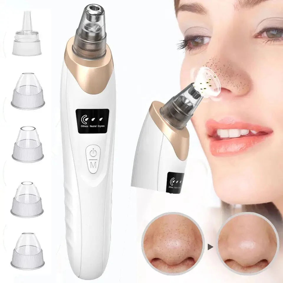 Blackhead Remover Vacuum – Electric Pore Cleaner Machine for Acne, Black Spots & Deep Facial Cleansing