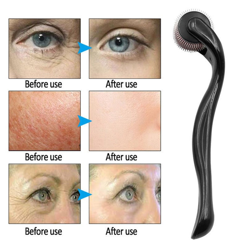 Dermaroller For Face & Hair – Microneedle Roller For Skin Rejuvenation, Beard Growth & Hair Regrowth